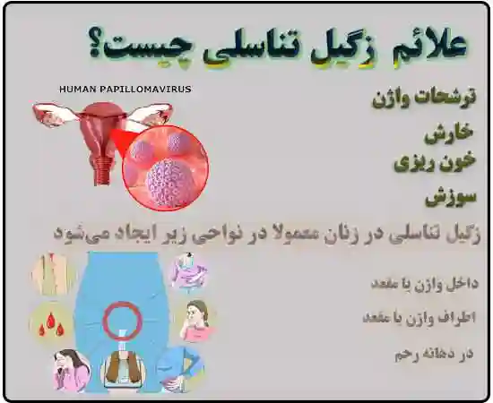 ,علائم زگیل تناسلی,